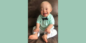 smiling baby with Down Syndrome